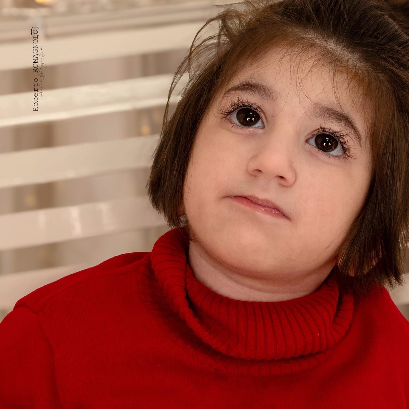 A young girl with MICPCH