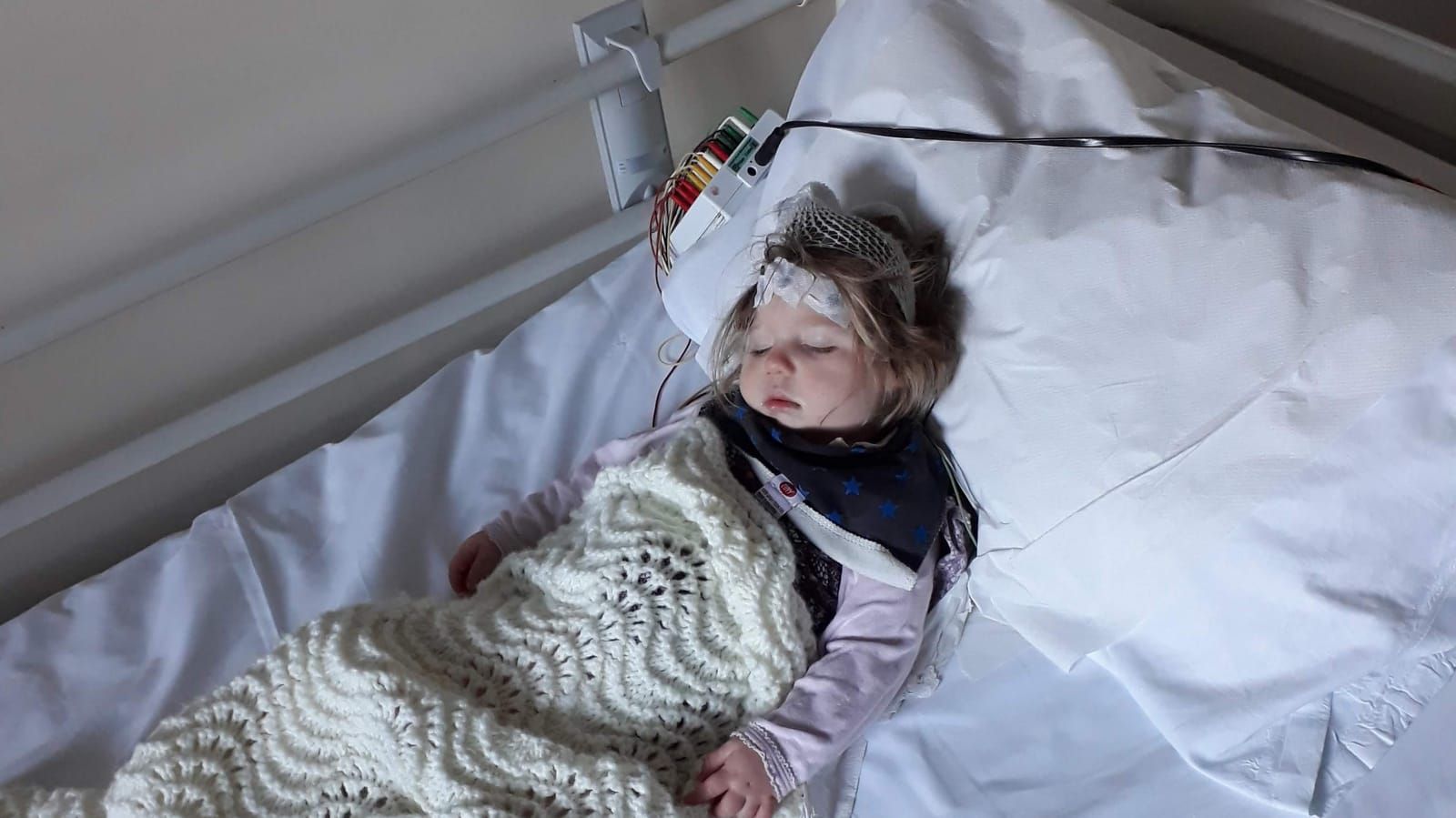 Advancing the understanding of epilepsy in CASK